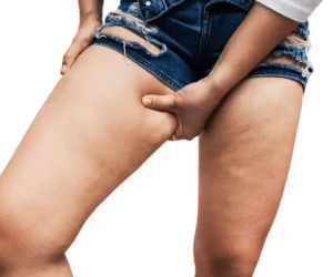 get rid of thigh fat